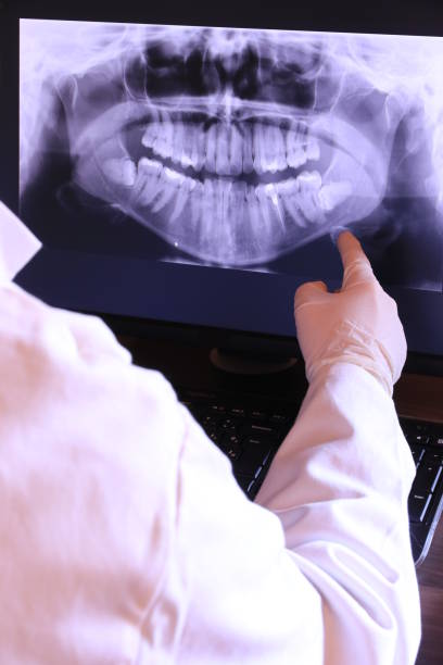 Best Emergency Tooth Extraction in Boulevard Gardens, FL