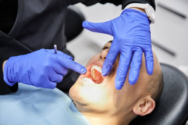 Best Emergency Root Canal Treatment in Boulevard Gardens, FL