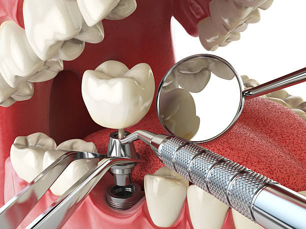 Best After-Hours Emergency Dentist in Boulevard Gardens, FL